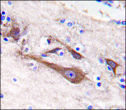 Anti-NCS1 (center) antibody produced in