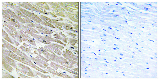 Anti-MRPL46 antibody produced in rabbit