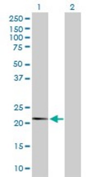 Anti-FAU antibody produced in rabbit