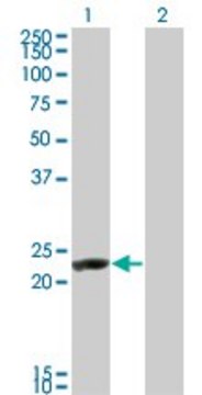 ANTI-RCV1 antibody produced in mouse