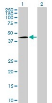 Anti-HOXD8 antibody produced in rabbit