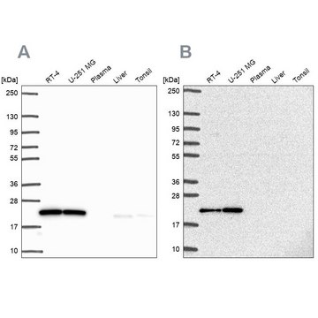 Anti-UBE2M antibody produced in rabbit