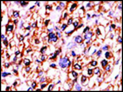 Anti-GUCY1B2 (C-term) antibody produced in