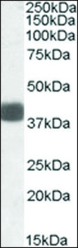 Anti-FBXO32 antibody produced in goat