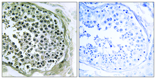Anti-GIDRP88 antibody produced in rabbit