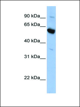 Anti-SLC45A3 antibody produced in rabbit