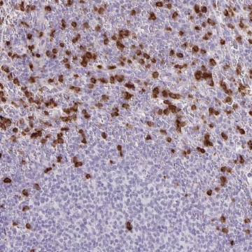Anti-ADCK1 antibody produced in rabbit