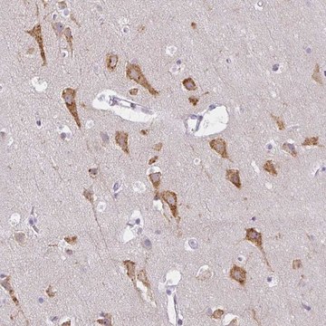 Anti-ZFYVE26 antibody produced in rabbit