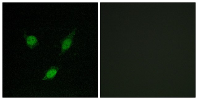 Anti-TACC1 antibody produced in rabbit