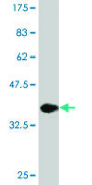 Monoclonal Anti-CNOT3, (N-terminal) antibody produced