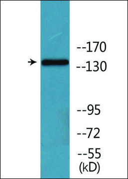 Anti-phospho-CD171/N-CAML1 (pSer¹¹?¹) antibody produced in