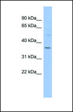 Anti-HMGCLL1, (N-terminal) antibody produced in
