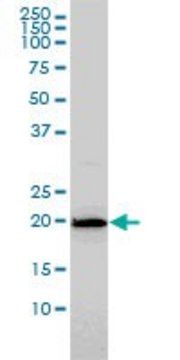 Monoclonal Anti-HYI antibody produced in