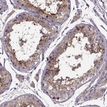 Anti-SLC52A3 antibody produced in rabbit