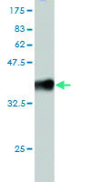 Monoclonal Anti-RNF20 antibody produced in