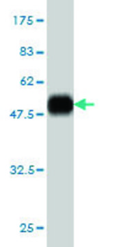 Monoclonal Anti-SLC45A2 antibody produced in