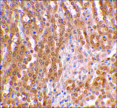 Anti-TIRP (ab2) antibody produced in