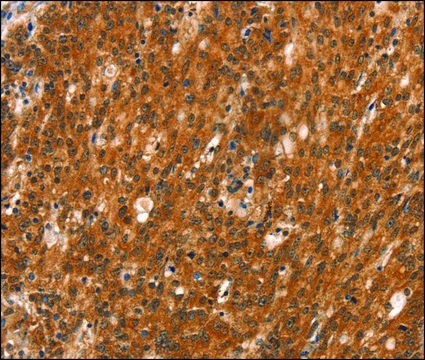 Anti-DAB2IP antibody produced in rabbit