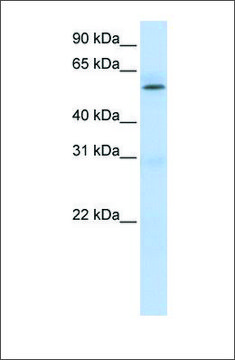 Anti-PRMT3 antibody produced in rabbit