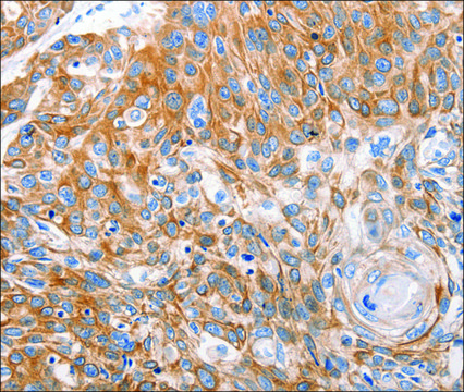 Anti-LRP2 antibody produced in rabbit