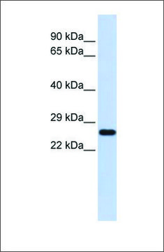 Anti-SOD2 antibody produced in rabbit