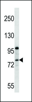 ANTI-PR15B(C-TERMINAL) antibody produced in rabbit