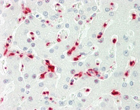 Anti-TENT4B (C-terminal) antibody produced in