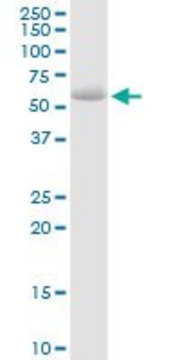 Anti-STS antibody produced in rabbit