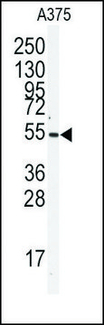 Anti-BPIL2 (center) antibody produced in