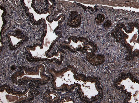 Anti-DPP4/CD26 antibody produced in goat