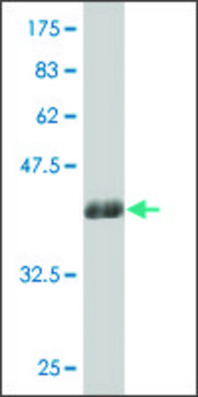 ANTI-LBX1 antibody produced in mouse
