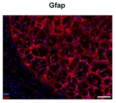 Anti-GFAP antibody produced in rabbit