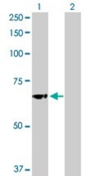 Anti-GBA antibody produced in rabbit