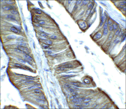 Anti-TET2 antibody produced in rabbit