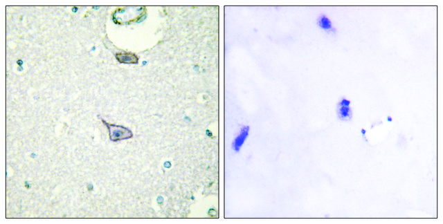 Anti-CADM4 antibody produced in rabbit