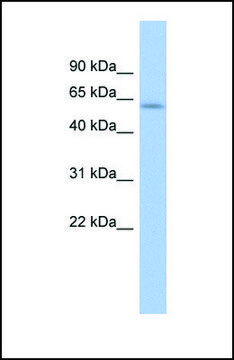 Anti-LEMD2 antibody produced in rabbit