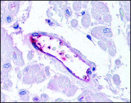 Anti-HUNK antibody produced in rabbit