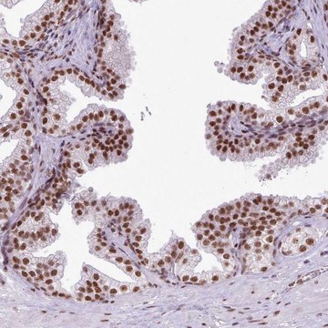 Anti-FAM182B antibody produced in rabbit
