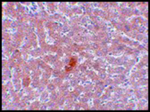 Anti-JMJD1A antibody produced in rabbit