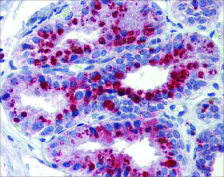 Anti-KCNK9 antibody produced in rabbit