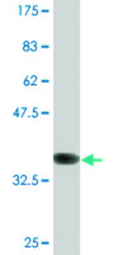 Monoclonal Anti-DIRAS3 antibody produced in