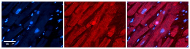 Anti-TSG101 (N-terminal) antibody produced in