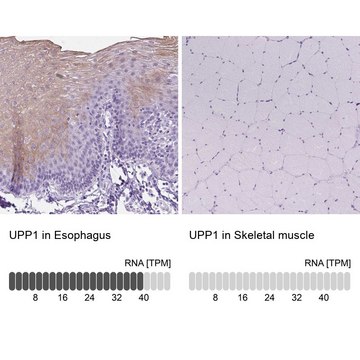 Anti-UPP1 antibody produced in rabbit