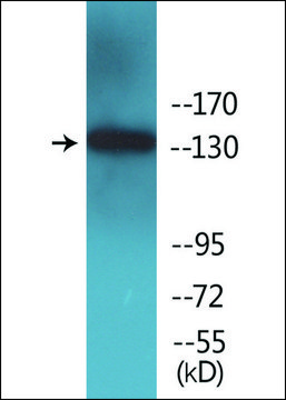 Anti-phospho-IRS-1 (pSer¹¹?¹) antibody produced in