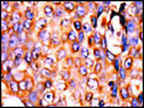 Anti-PANK3 (center) antibody produced in