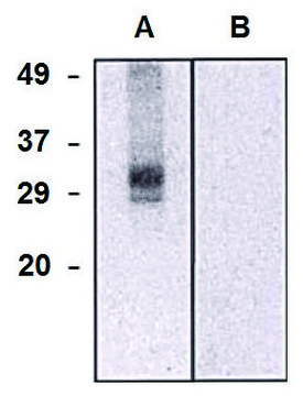 Monoclonal Anti-CLIC5 antibody produced in