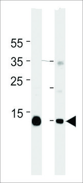 MONOCLONAL ANTI-MYOGLOBIN antibody produced in