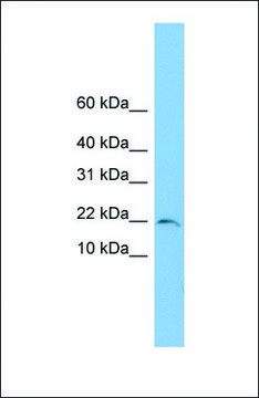Anti-TRAPPC1 antibody produced in rabbit