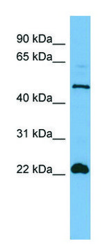Anti-HEMGN (N-terminal) antibody produced in