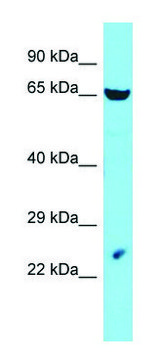 Anti-LIN54 (C-terminal) antibody produced in